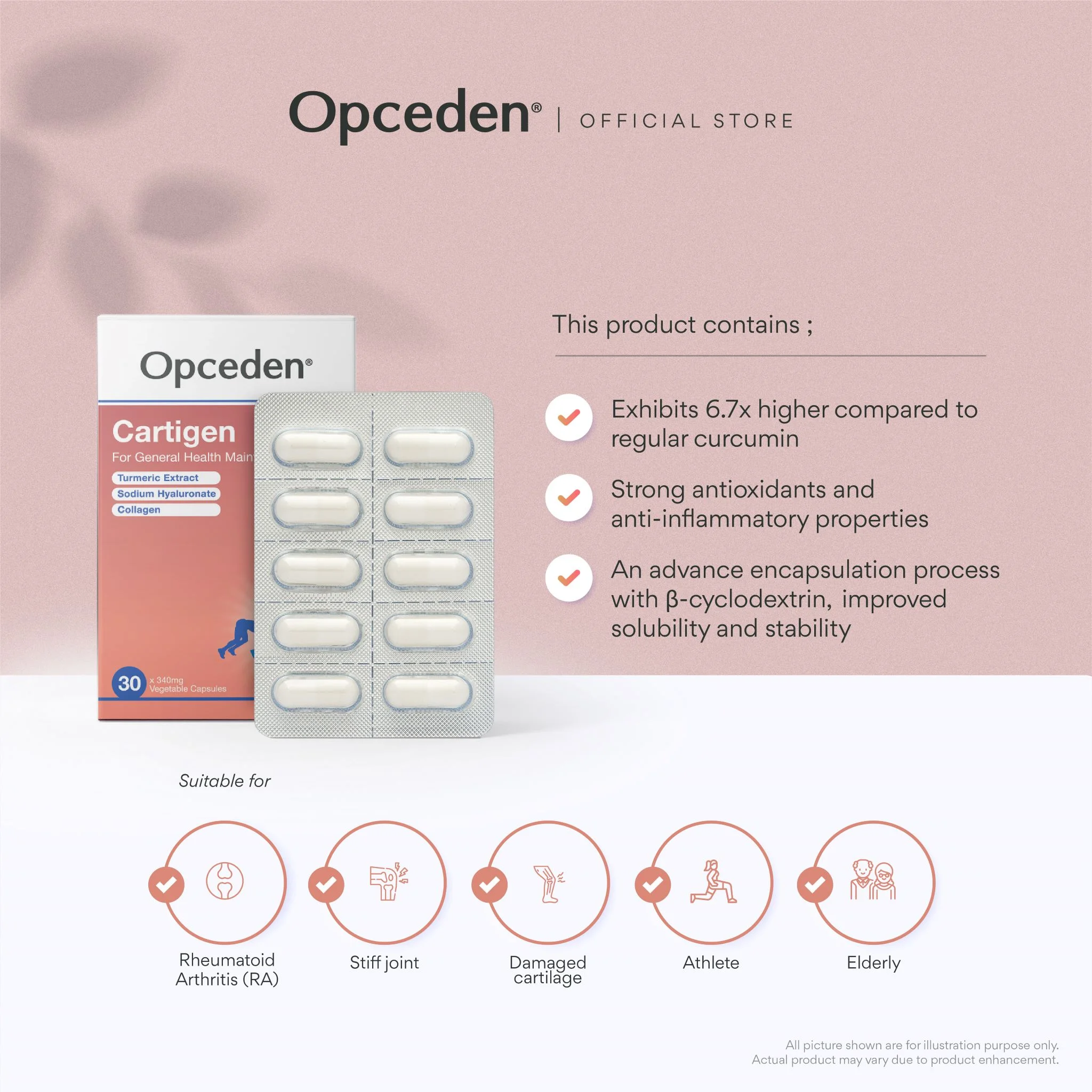Opceden Cartigen (34