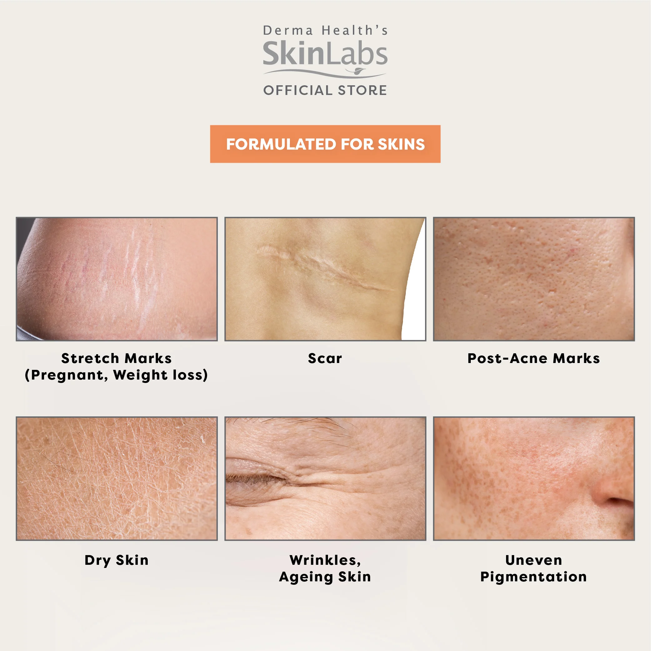 Derma Health's SkinL