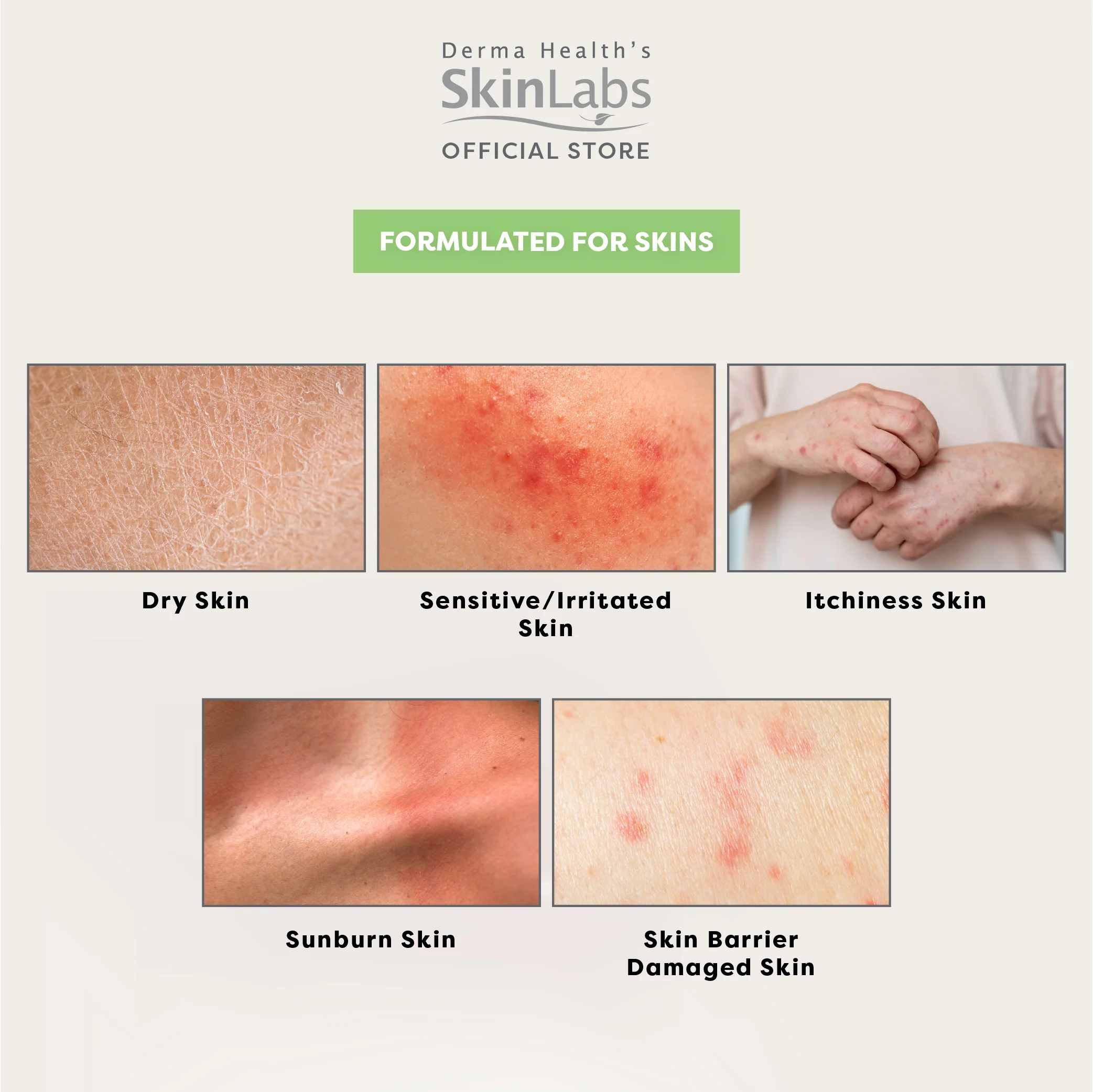 Derma Health's Skinl