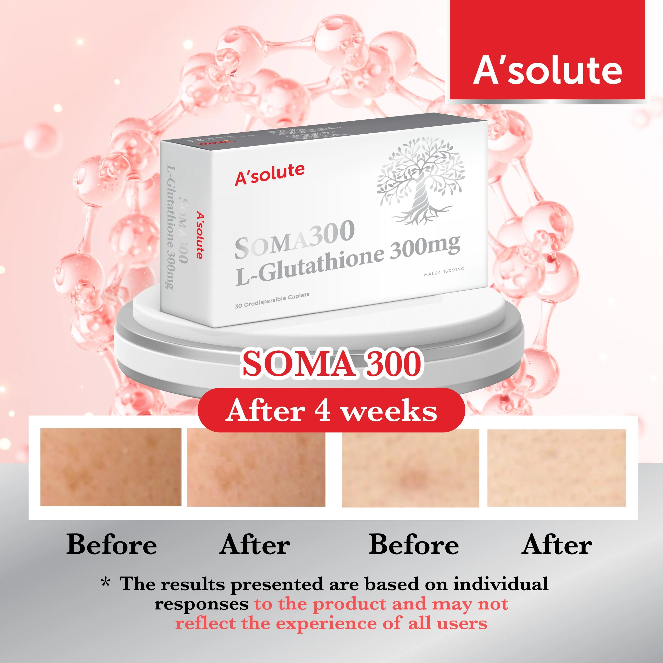 A'SOLUTE SOMA300 30S
